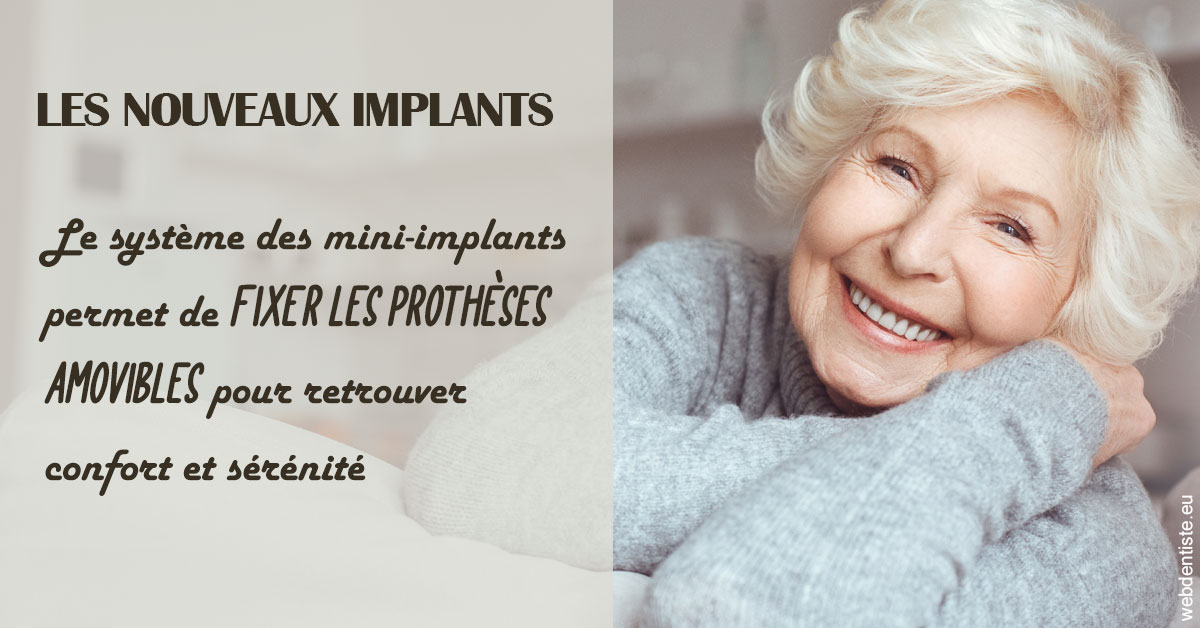 https://dr-patrick-bermot.chirurgiens-dentistes.fr/Les nouveaux implants 1