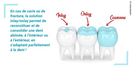 https://dr-patrick-bermot.chirurgiens-dentistes.fr/L'INLAY ou l'ONLAY
