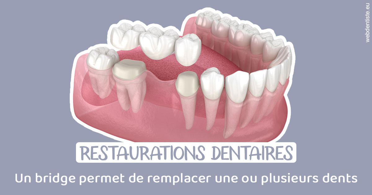 https://dr-patrick-bermot.chirurgiens-dentistes.fr/Bridge remplacer dents 1