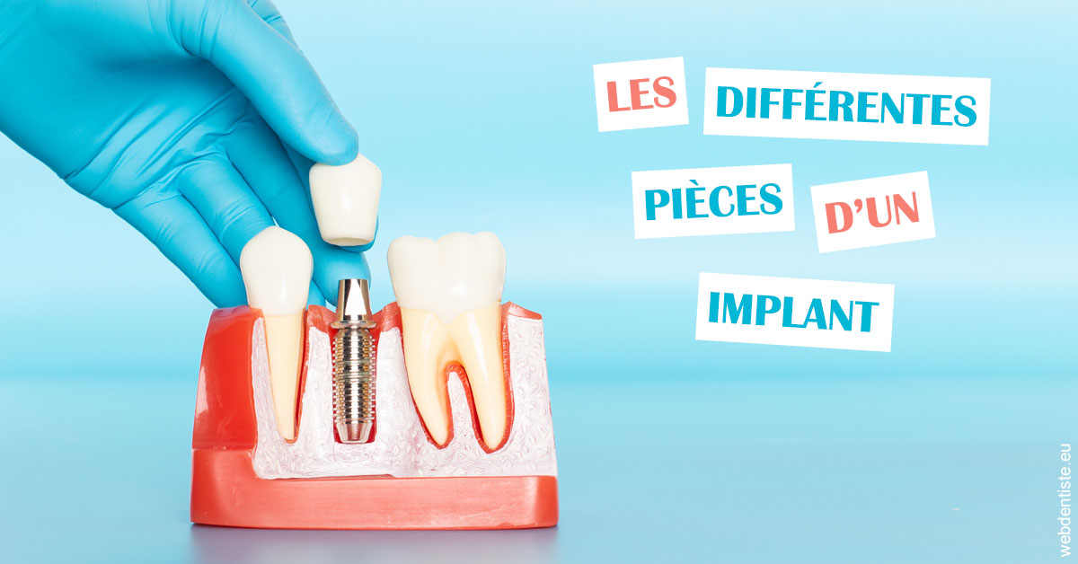 https://dr-patrick-bermot.chirurgiens-dentistes.fr/Les différentes pièces d’un implant 2
