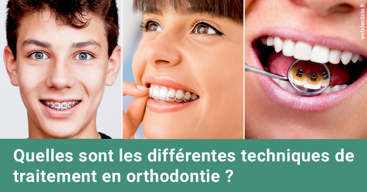 https://dr-patrick-bermot.chirurgiens-dentistes.fr/Les différentes techniques de traitement 2