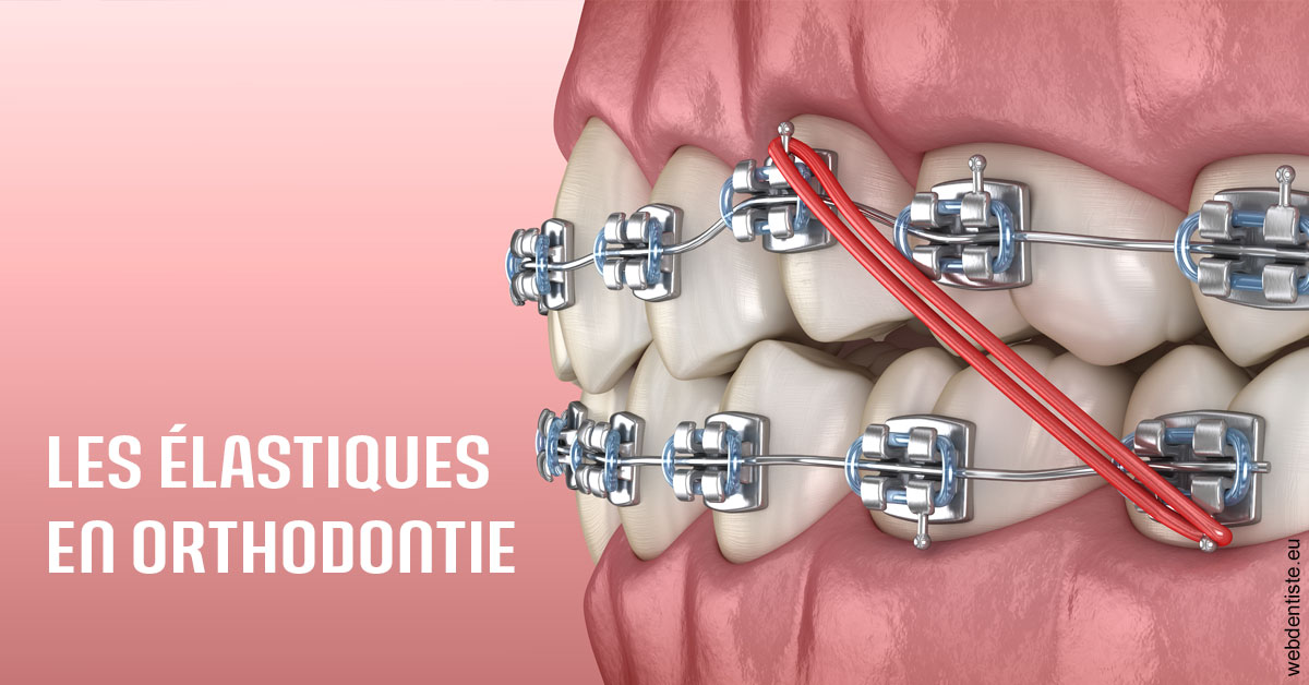 https://dr-patrick-bermot.chirurgiens-dentistes.fr/Elastiques orthodontie 2